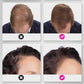 🔥BUY 1 GET 1 FREE💝Hair Thickening Hair Building Fiber Powder