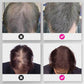 🔥BUY 1 GET 1 FREE💝Hair Thickening Hair Building Fiber Powder